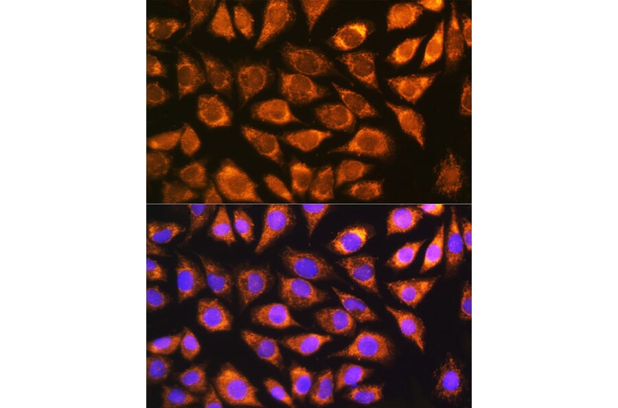 Immunofluorescence - Anti-NDUFS5 Antibody (A307602) - Antibodies.com