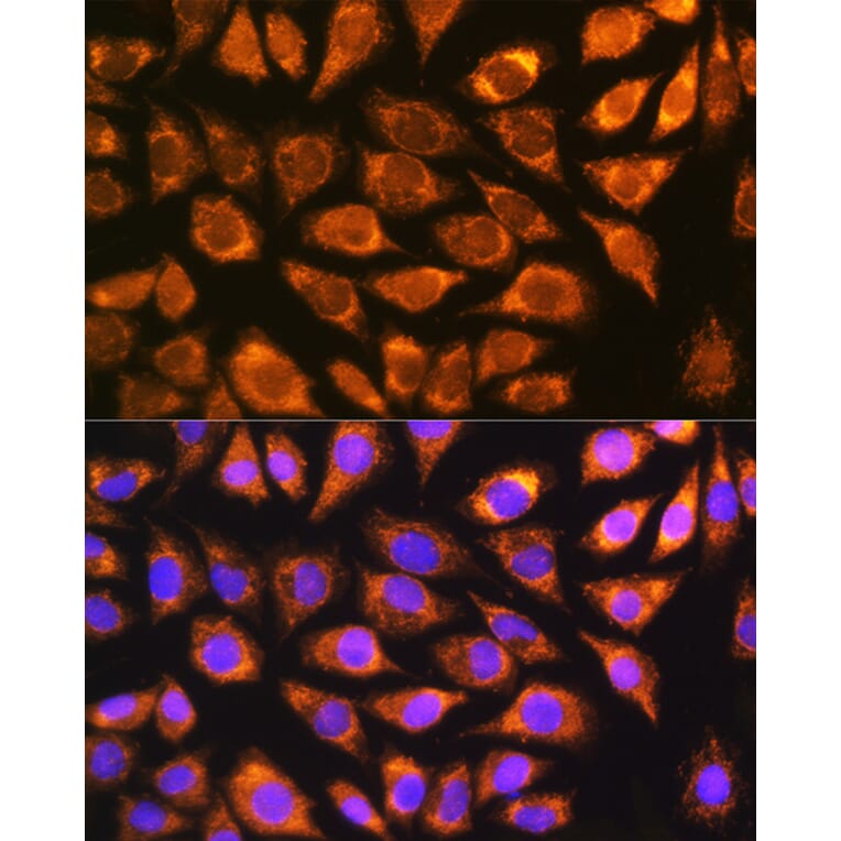 Immunofluorescence - Anti-NDUFS5 Antibody (A307602) - Antibodies.com
