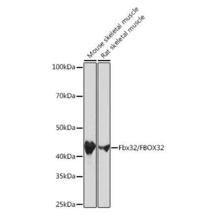 Western Blot - Anti-Fbx32 Antibody [ARC0830] (A307603) - Antibodies.com