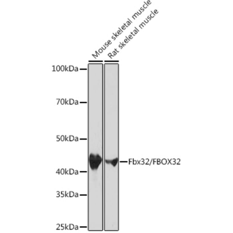 Western Blot - Anti-Fbx32 Antibody [ARC0830] (A307603) - Antibodies.com