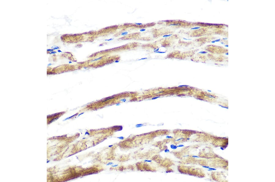 Immunohistochemistry - Anti-Fbx32 Antibody [ARC0830] (A307603) - Antibodies.com