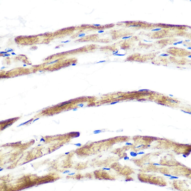 Immunohistochemistry - Anti-Fbx32 Antibody [ARC0830] (A307603) - Antibodies.com