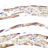 Immunohistochemistry - Anti-Fbx32 Antibody [ARC0830] (A307603) - Antibodies.com