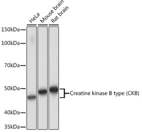 Western Blot - Anti-Creatine Kinase MB Antibody [ARC1990] (A307604) - Antibodies.com