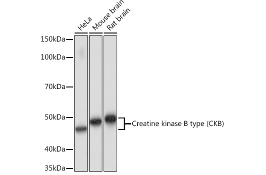 Western Blot - Anti-Creatine Kinase MB Antibody [ARC1990] (A307604) - Antibodies.com