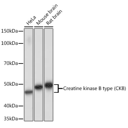 Western Blot - Anti-Creatine Kinase MB Antibody [ARC1990] (A307604) - Antibodies.com