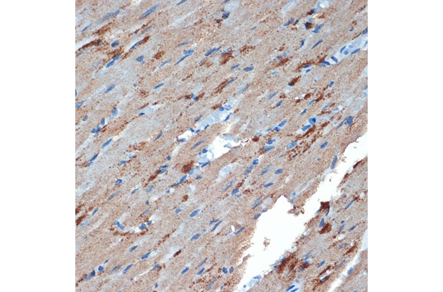 Immunohistochemistry - Anti-Creatine Kinase MB Antibody [ARC1990] (A307604) - Antibodies.com
