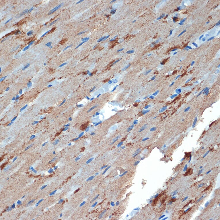 Immunohistochemistry - Anti-Creatine Kinase MB Antibody [ARC1990] (A307604) - Antibodies.com