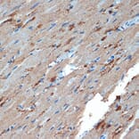 Immunohistochemistry - Anti-Creatine Kinase MB Antibody [ARC1990] (A307604) - Antibodies.com