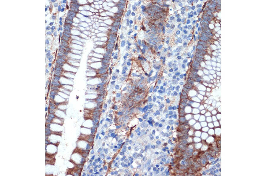 Immunohistochemistry - Anti-Creatine Kinase MB Antibody [ARC1990] (A307604) - Antibodies.com