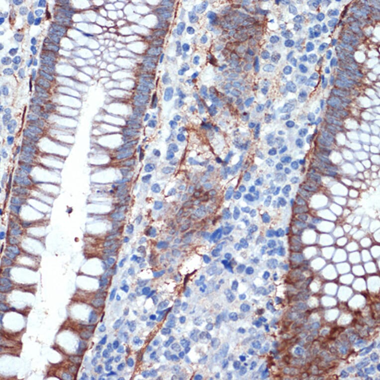 Immunohistochemistry - Anti-Creatine Kinase MB Antibody [ARC1990] (A307604) - Antibodies.com