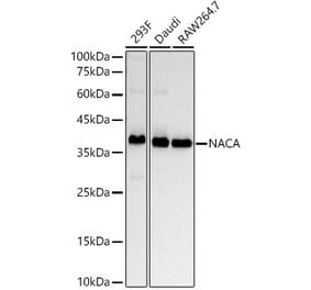 Western Blot - Anti-NACA1 Antibody [ARC53721] (A307605) - Antibodies.com