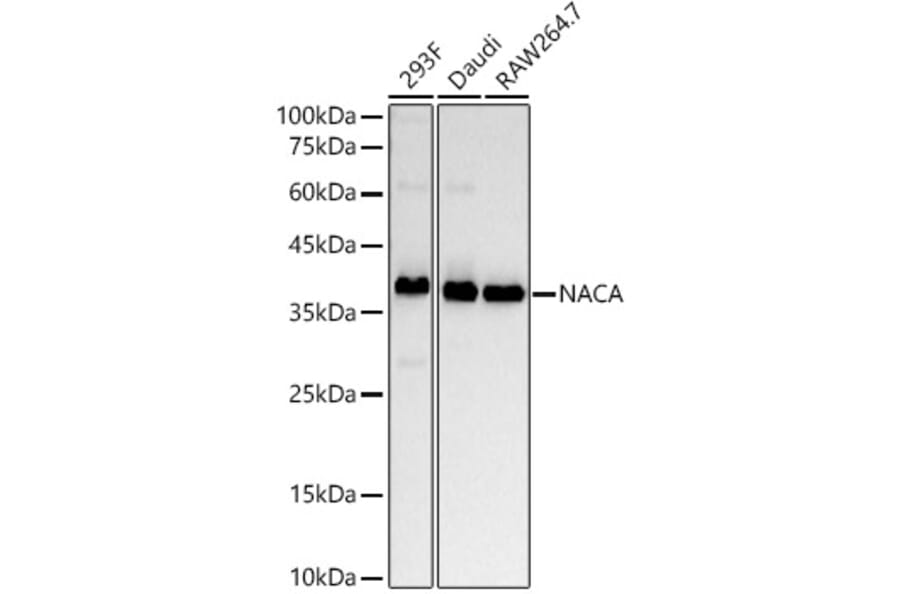 Western Blot - Anti-NACA1 Antibody [ARC53721] (A307605) - Antibodies.com