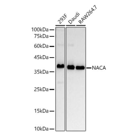 Western Blot - Anti-NACA1 Antibody [ARC53721] (A307605) - Antibodies.com