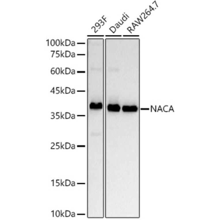 Western Blot - Anti-NACA1 Antibody [ARC53721] (A307605) - Antibodies.com