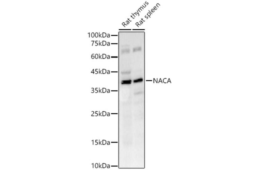 Western Blot - Anti-NACA1 Antibody [ARC53721] (A307605) - Antibodies.com