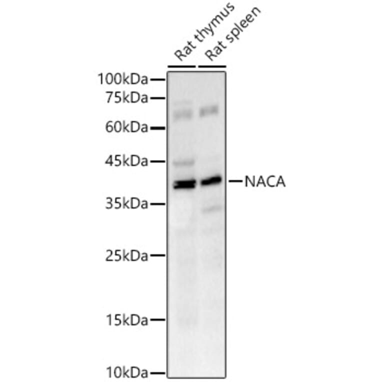 Western Blot - Anti-NACA1 Antibody [ARC53721] (A307605) - Antibodies.com