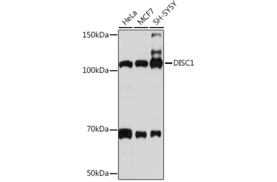 Western Blot - Anti-DISC1 Antibody [ARC1089] (A307606) - Antibodies.com