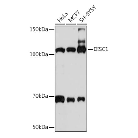 Western Blot - Anti-DISC1 Antibody [ARC1089] (A307606) - Antibodies.com