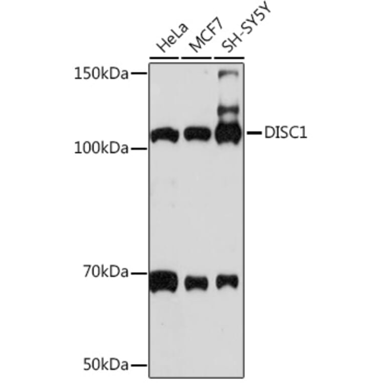 Western Blot - Anti-DISC1 Antibody [ARC1089] (A307606) - Antibodies.com