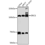 Western Blot - Anti-DISC1 Antibody [ARC1089] (A307606) - Antibodies.com