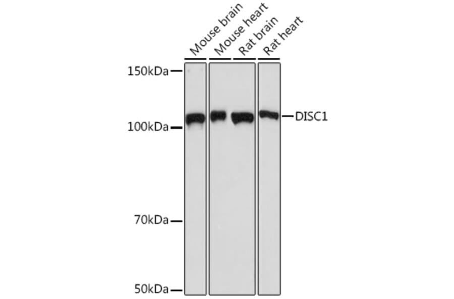 Western Blot - Anti-DISC1 Antibody [ARC1089] (A307606) - Antibodies.com