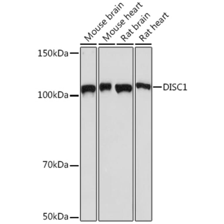Western Blot - Anti-DISC1 Antibody [ARC1089] (A307606) - Antibodies.com