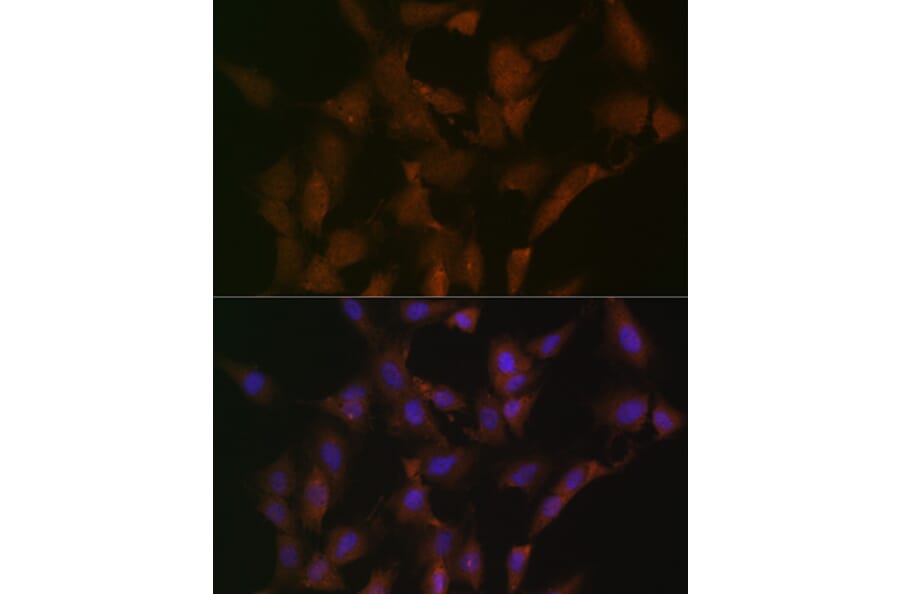 Immunofluorescence - Anti-DISC1 Antibody [ARC1089] (A307606) - Antibodies.com