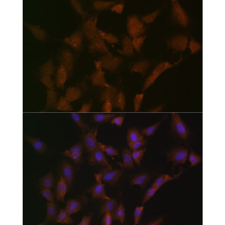 Immunofluorescence - Anti-DISC1 Antibody [ARC1089] (A307606) - Antibodies.com