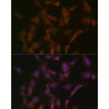 Immunofluorescence - Anti-DISC1 Antibody [ARC1089] (A307606) - Antibodies.com