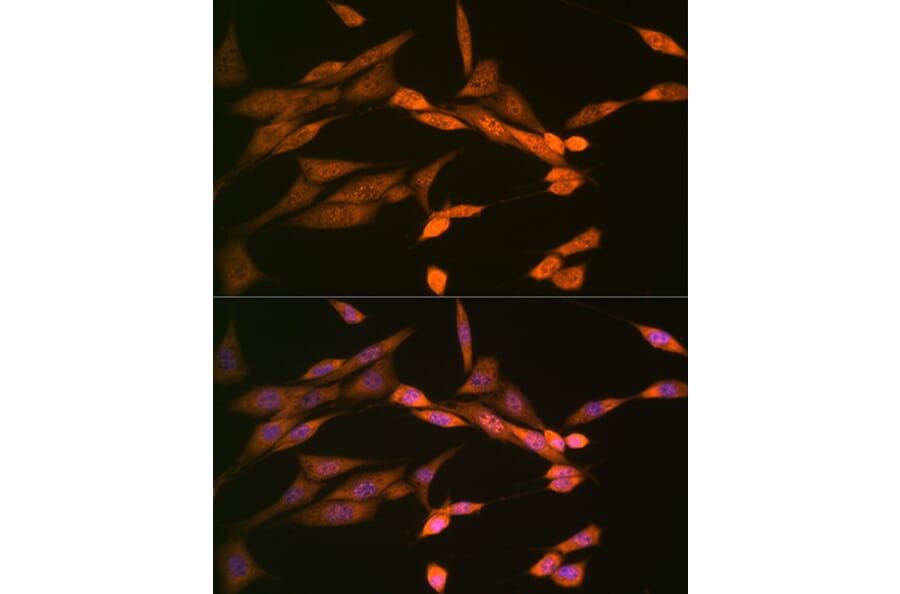 Immunofluorescence - Anti-DISC1 Antibody [ARC1089] (A307606) - Antibodies.com