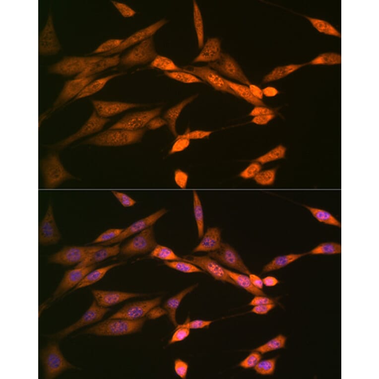Immunofluorescence - Anti-DISC1 Antibody [ARC1089] (A307606) - Antibodies.com