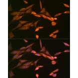 Immunofluorescence - Anti-DISC1 Antibody [ARC1089] (A307606) - Antibodies.com
