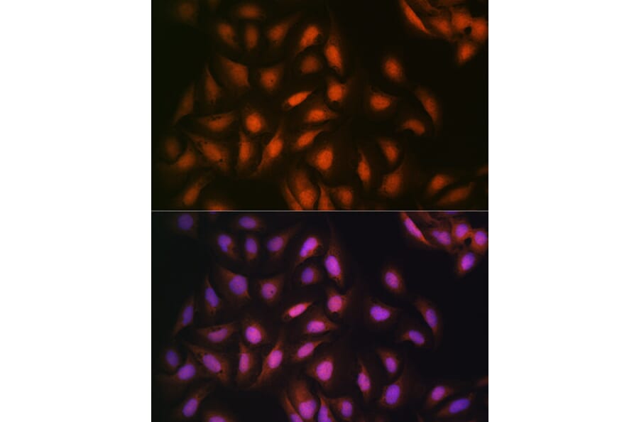 Immunofluorescence - Anti-DISC1 Antibody [ARC1089] (A307606) - Antibodies.com