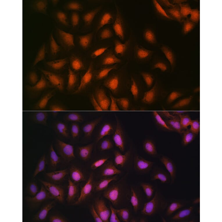 Immunofluorescence - Anti-DISC1 Antibody [ARC1089] (A307606) - Antibodies.com