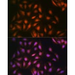 Immunofluorescence - Anti-DISC1 Antibody [ARC1089] (A307606) - Antibodies.com