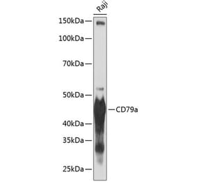 Western Blot - Anti-CD79a Antibody (A307607) - Antibodies.com