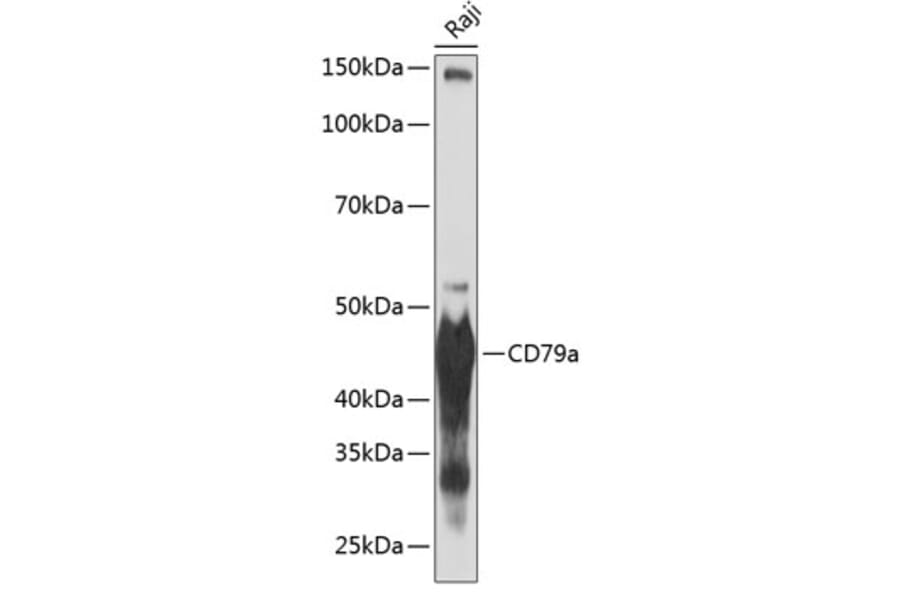 Western Blot - Anti-CD79a Antibody [ARC0482] (A307607) - Antibodies.com