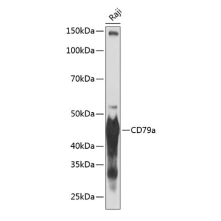 Western Blot - Anti-CD79a Antibody [ARC0482] (A307607) - Antibodies.com