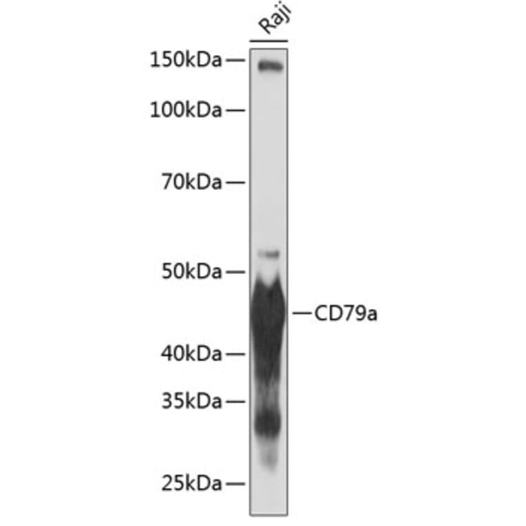 Western Blot - Anti-CD79a Antibody [ARC0482] (A307607) - Antibodies.com