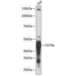 Western Blot - Anti-CD79a Antibody [ARC0482] (A307607) - Antibodies.com