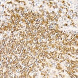 Immunohistochemistry - Anti-CD79a Antibody [ARC0482] (A307607) - Antibodies.com