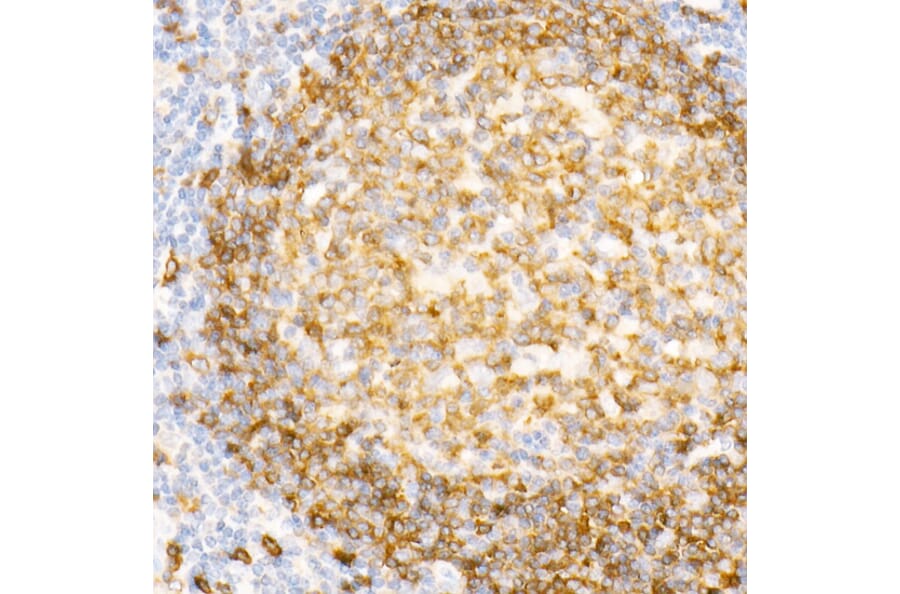 Immunohistochemistry - Anti-CD79a Antibody [ARC0482] (A307607) - Antibodies.com