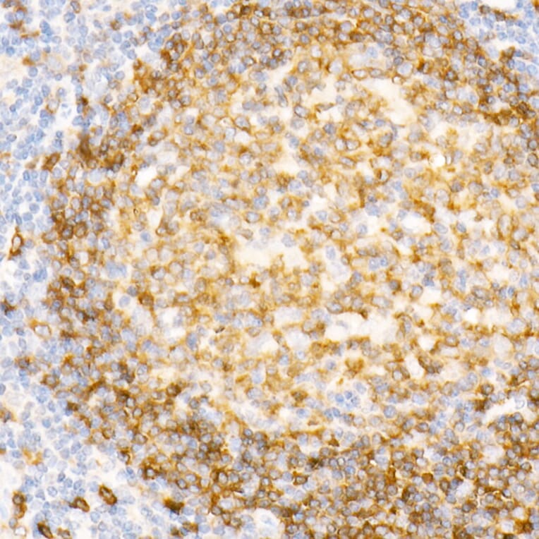 Immunohistochemistry - Anti-CD79a Antibody [ARC0482] (A307607) - Antibodies.com