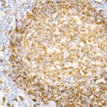 Immunohistochemistry - Anti-CD79a Antibody [ARC0482] (A307607) - Antibodies.com