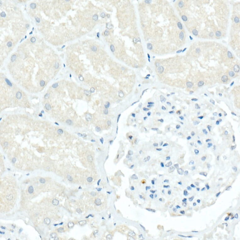 Immunohistochemistry - Anti-CD79a Antibody [ARC0482] (A307607) - Antibodies.com