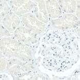 Immunohistochemistry - Anti-CD79a Antibody [ARC0482] (A307607) - Antibodies.com