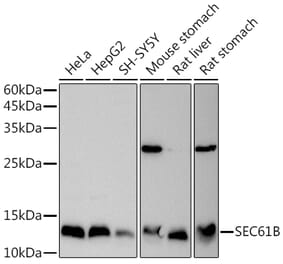 Western Blot - Anti-SEC61B Antibody (A307609) - Antibodies.com