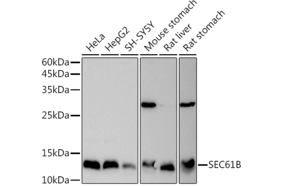 Western Blot - Anti-SEC61B Antibody (A307609) - Antibodies.com