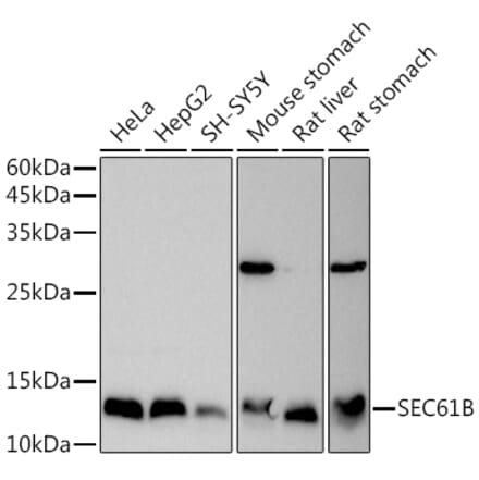 Western Blot - Anti-SEC61B Antibody (A307609) - Antibodies.com